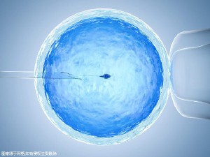 代怀选性别包生男孩